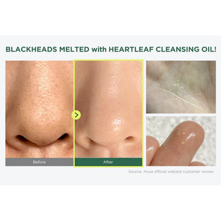 Anua Heartleaf Pore Control Cleansing Oil 200 ml