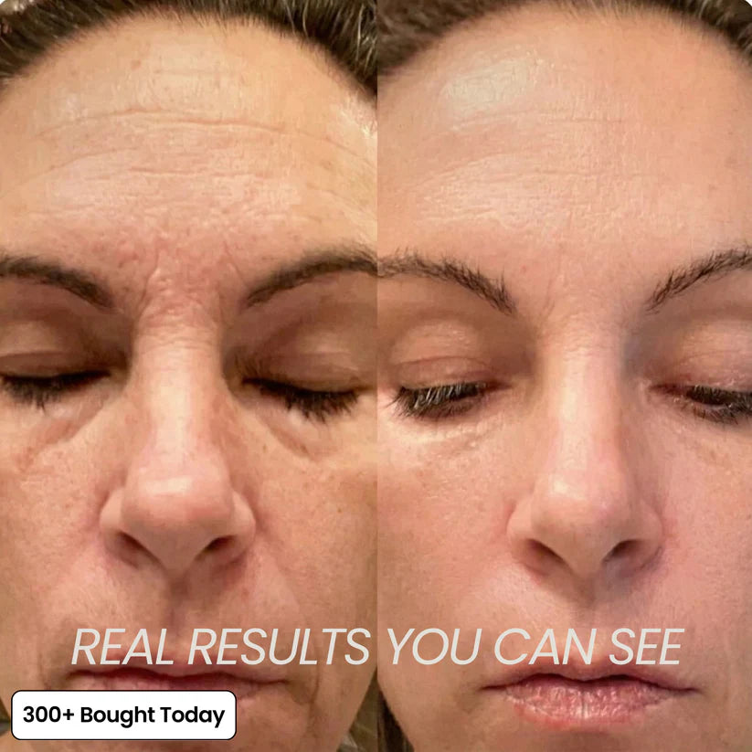 Before / After